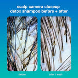 K18 Biomimetic Hairscience 
PEPTIDE PREP™ Clarifying Detox Shampoo