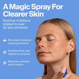 Magic Molecule Hypochlorous Acid Skin Spray 3.4oz/2ct: Non-Toxic, Vegan, For Sensitive Skin