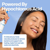 Magic Molecule Hypochlorous Acid Skin Spray 3.4oz/2ct: Non-Toxic, Vegan, For Sensitive Skin